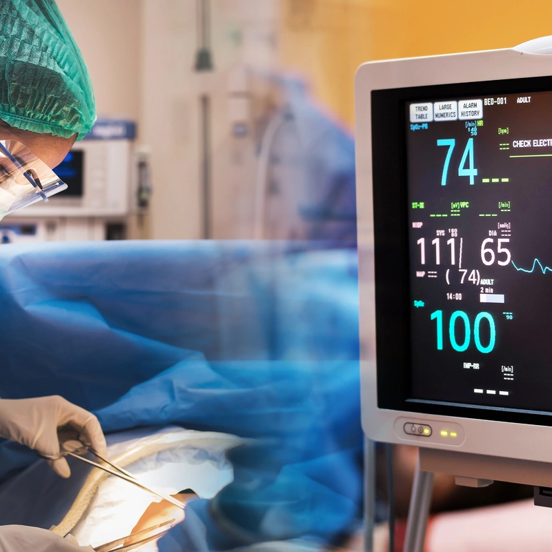 Electrocardiograma
